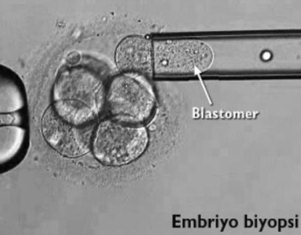  Embriyolarda PGT ve HLA tiplemesi