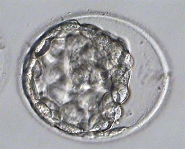 Embriyoların Dondurulmasında Yeni Bir Teknik: Vitrifikasyon