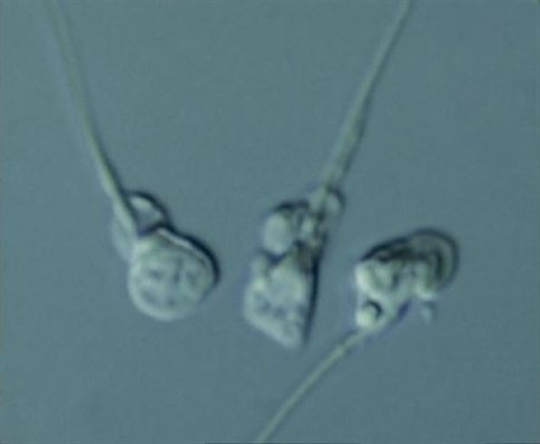 Yüksek Mikroskobik Büyütmeyle Seçilmiş Sperm Mikroenjeksiyonu