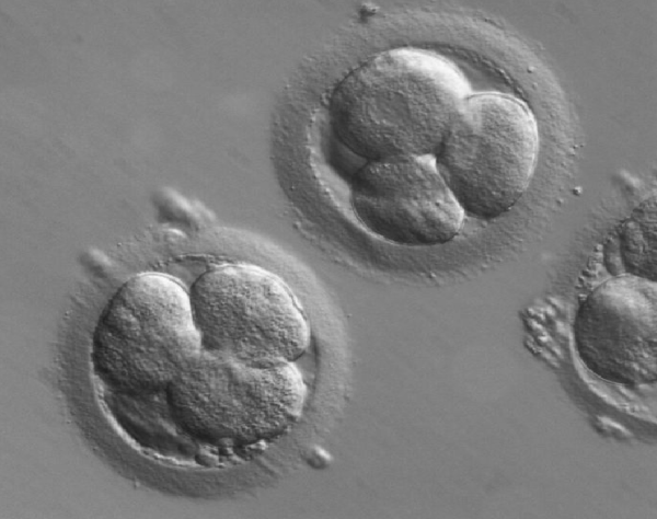Embriyoloji laboratuvarı bakış açısı ile transfer edilecek embriyo sayısı ve çoğul gebelik ilişkisi