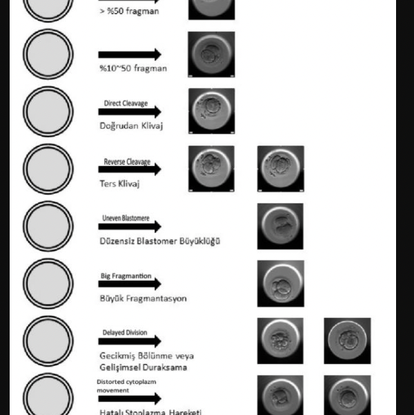 Kesintisiz Sürekli İzleme Sisteminde (Timelapse Imaging) Anormal Hücre Bölünme Davranışlarının Embriyo Gelişimine Etkisi