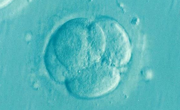 Tüp Bebek Tedavisinde Tek Embriyo Dönemi