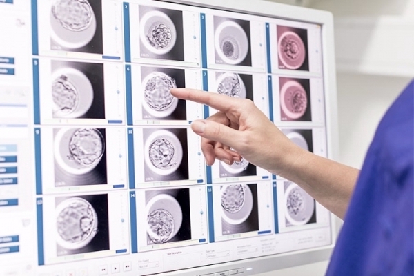 Yapay Zeka Destekli Sürekli Embriyo Görüntüleme ve İzleme (Time-Lapse)