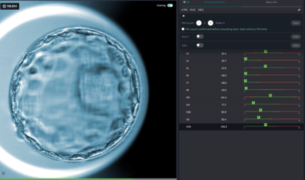 Yapay Zekâ (Artificial intelligence =AI) IVF Süreçlerini Nasıl Değiştiriyor?